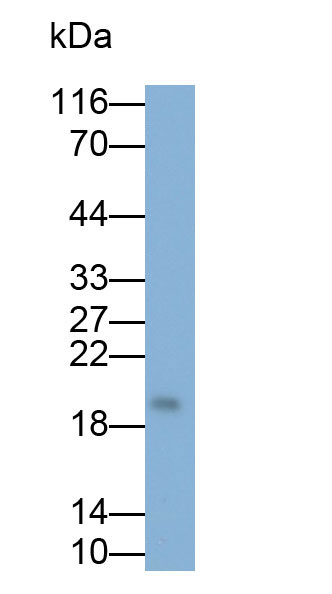 Polyclonal Antibody to Interleukin 1 Receptor Antagonist (IL1RA)