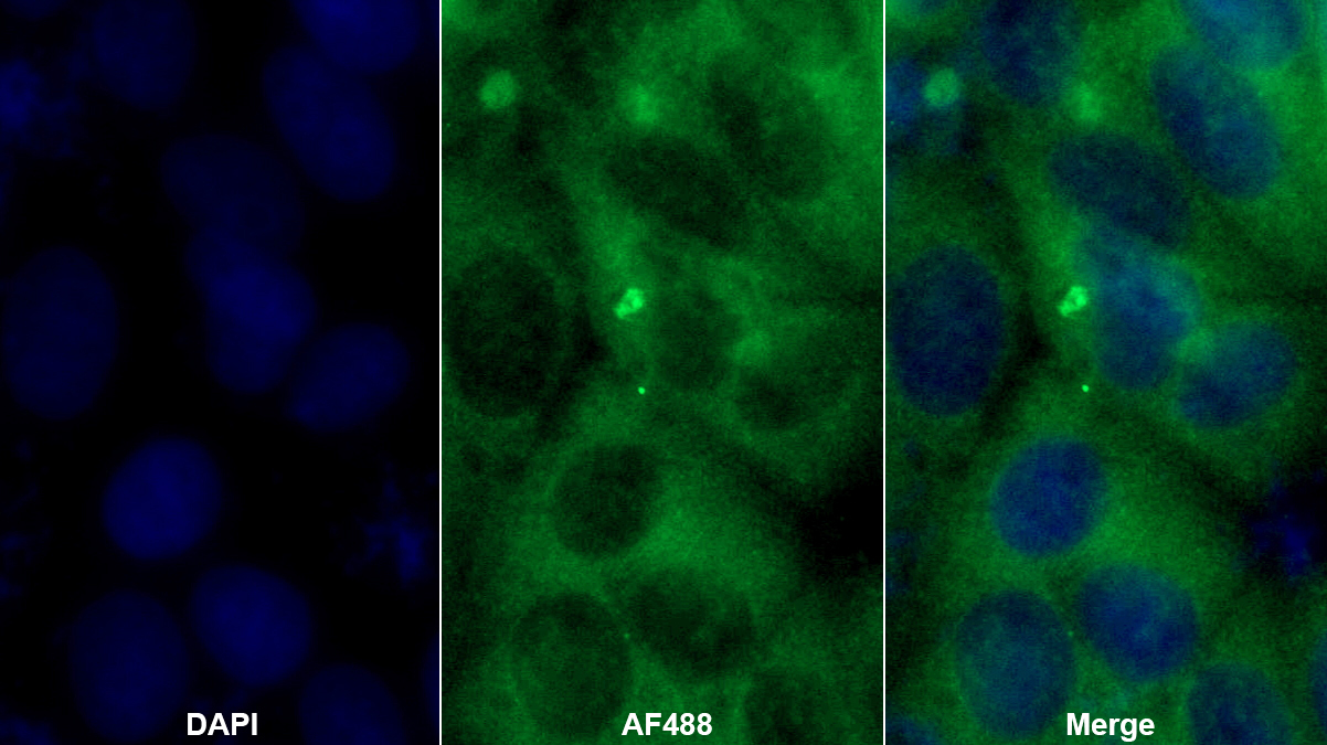 Polyclonal Antibody to Protein Kinase C Eta (PKCh)