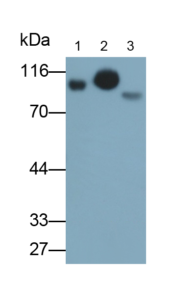 Polyclonal Antibody to Complement 1 Inhibitor (C1INH)