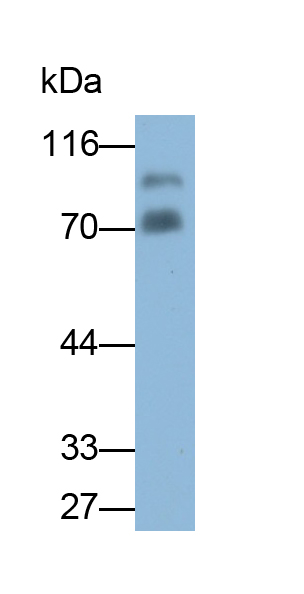 Polyclonal Antibody to Complement 1 Inhibitor (C1INH)