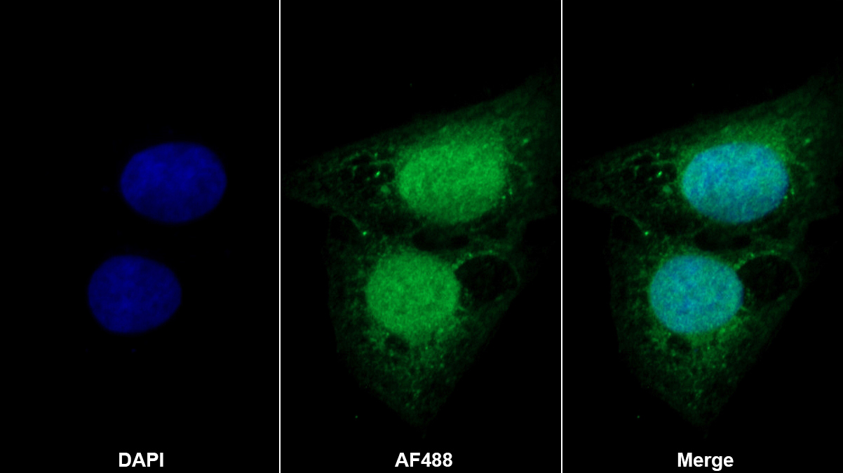 Polyclonal Antibody to Nischarin (NISCH)