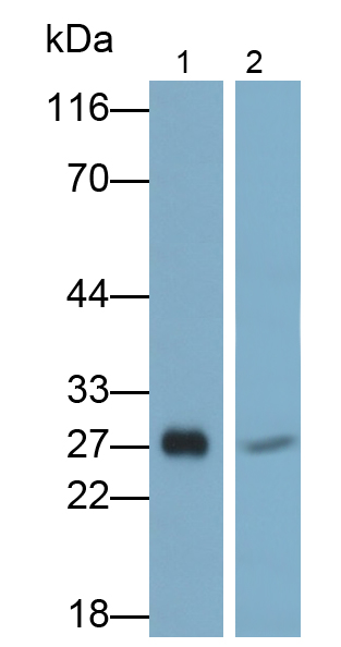 Polyclonal Antibody to Trypsin (TRY)