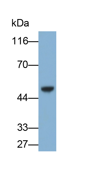 Polyclonal Antibody to Beta-2-Microglobulin (b2M)