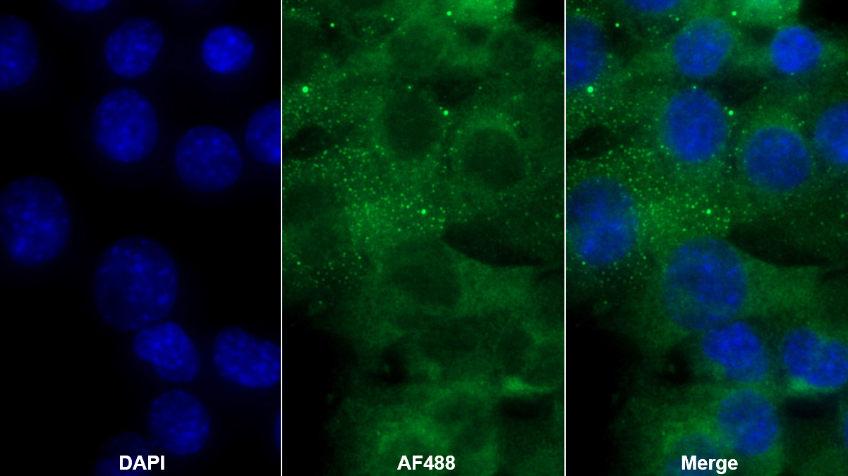 Polyclonal Antibody to Beta-2-Microglobulin (b2M)