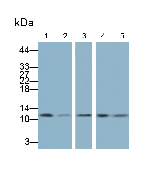 Polyclonal Antibody to Beta-2-Microglobulin (b2M)
