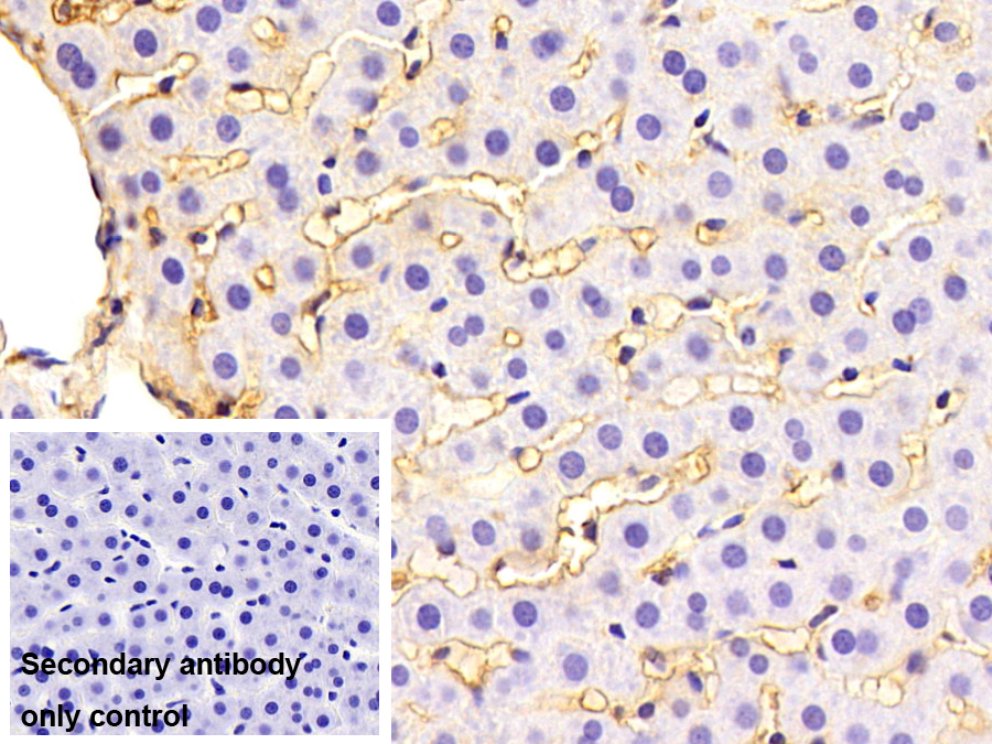 Polyclonal Antibody to Beta-2-Microglobulin (b2M)