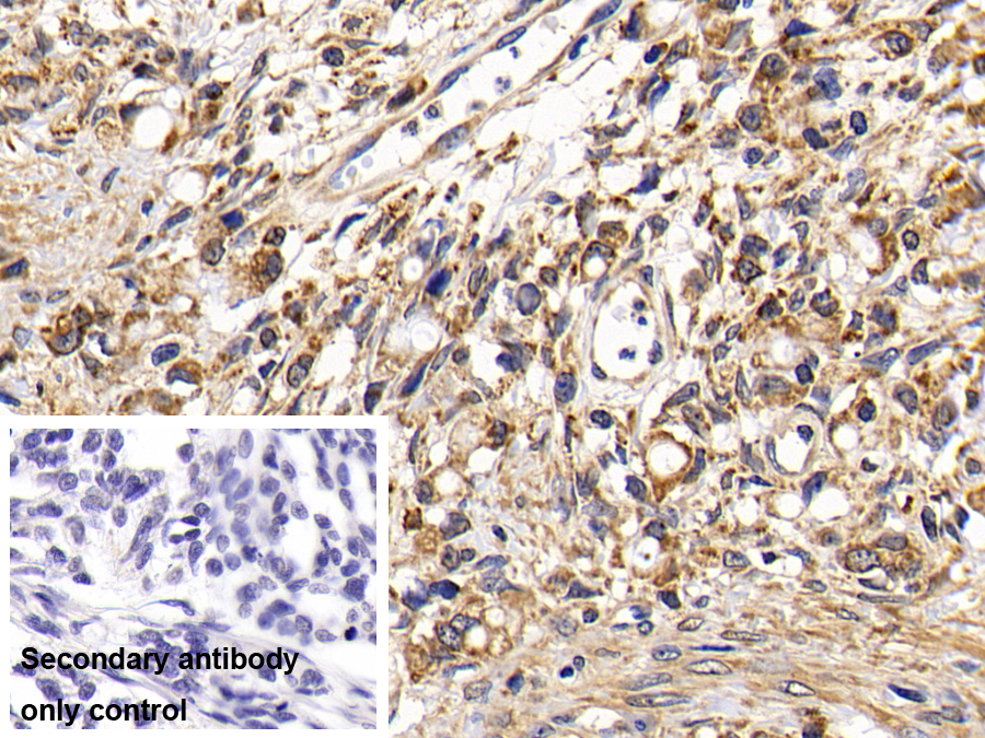 Polyclonal Antibody to Cathepsin K (CTSK)