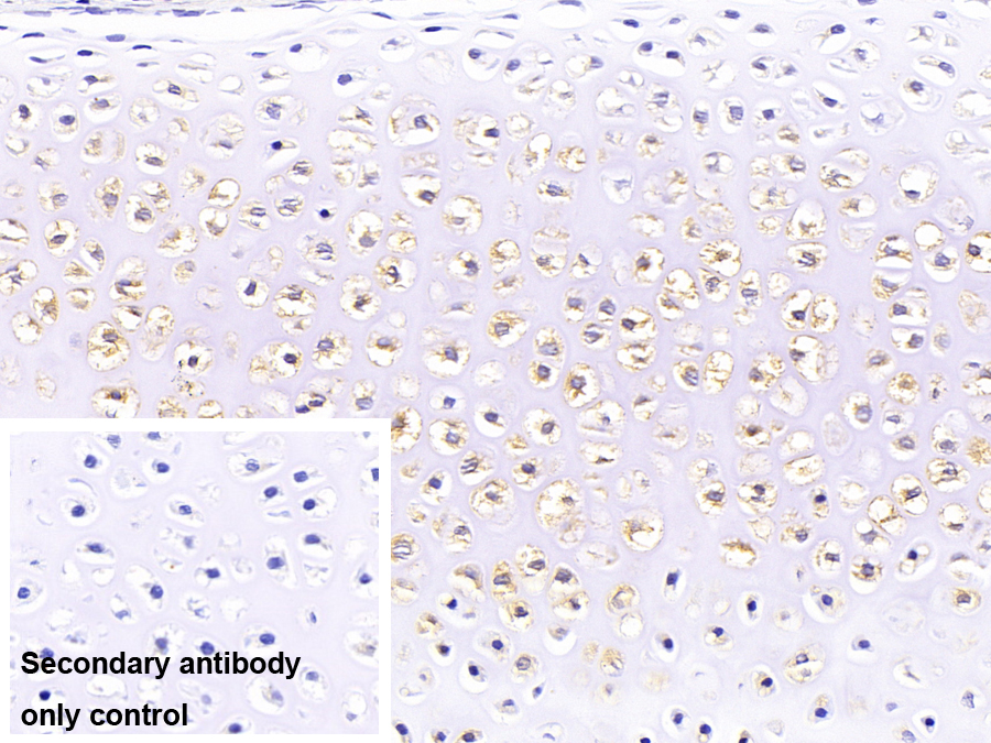 Polyclonal Antibody to Cathepsin K (CTSK)