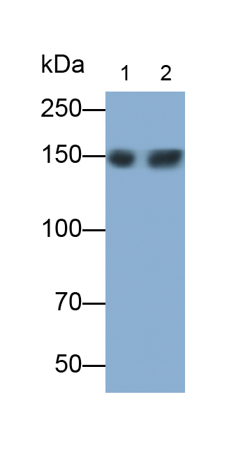 Polyclonal Antibody to Phospholipase C Gamma 1 (PLCg1)