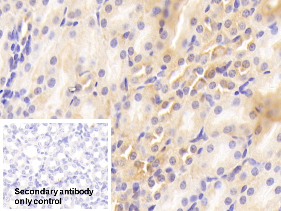 Polyclonal Antibody to Galectin 2 (GAL2)