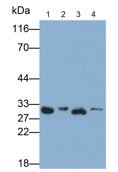 Polyclonal Antibody to Galectin 3 (GAL3)