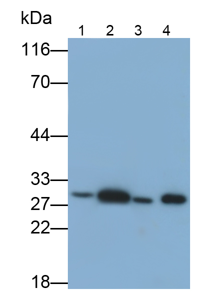 Polyclonal Antibody to Galectin 3 (GAL3)