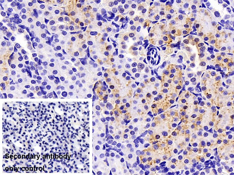 Polyclonal Antibody to Cathepsin L (CTSL)