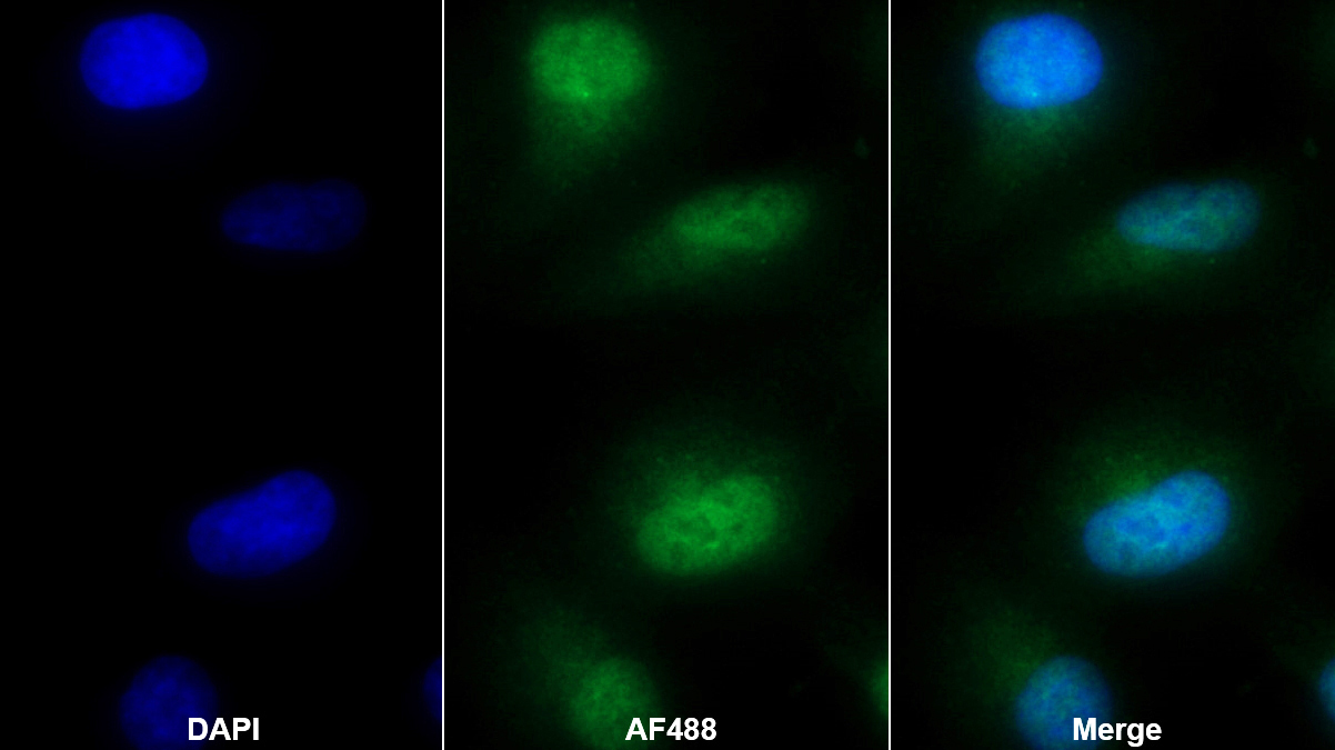 Polyclonal Antibody to Cathepsin L (CTSL)