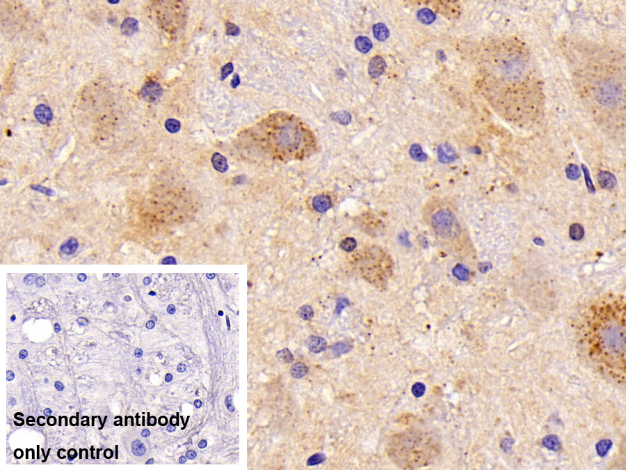 Polyclonal Antibody to Cathepsin L (CTSL)