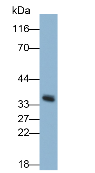 Polyclonal Antibody to Galectin 9 (GAL9)