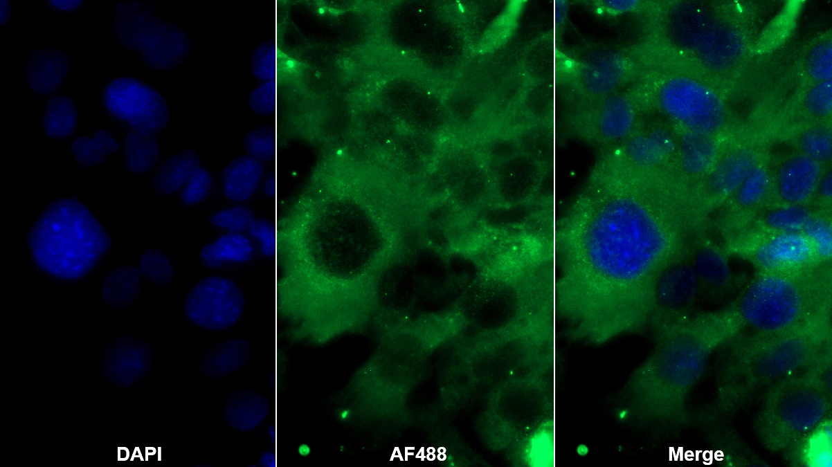 Polyclonal Antibody to Apolipoprotein H (APOH)