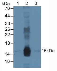 Polyclonal Antibody to Damage Specific DNA Binding Protein 2 (DDB2)