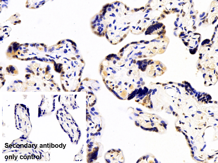 Polyclonal Antibody to Heterogeneous Nuclear Ribonucleoprotein A2/B1 (HNRPA2B1)