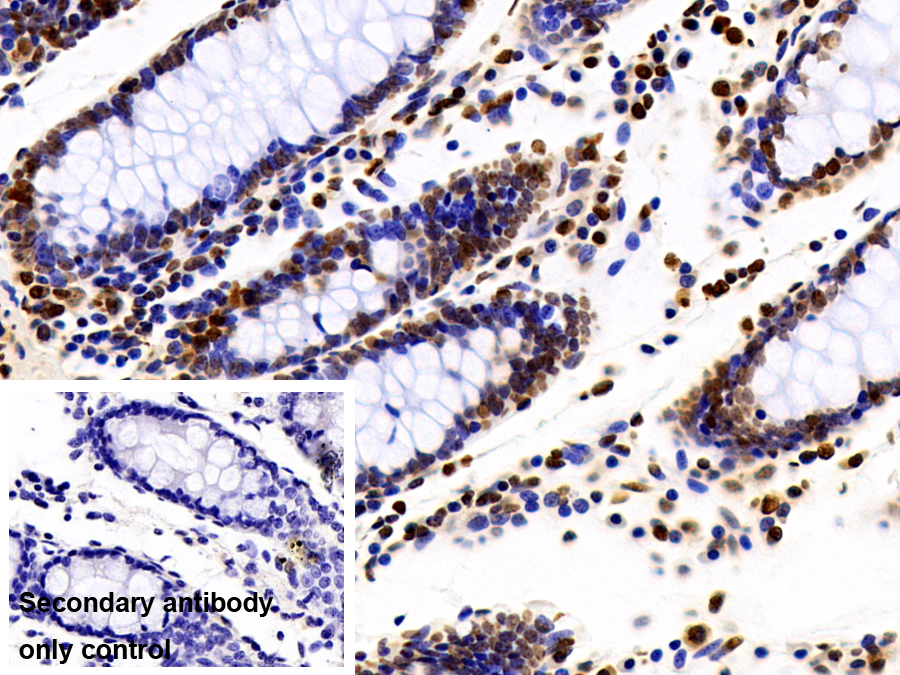 Polyclonal Antibody to Heterogeneous Nuclear Ribonucleoprotein A2/B1 (HNRPA2B1)