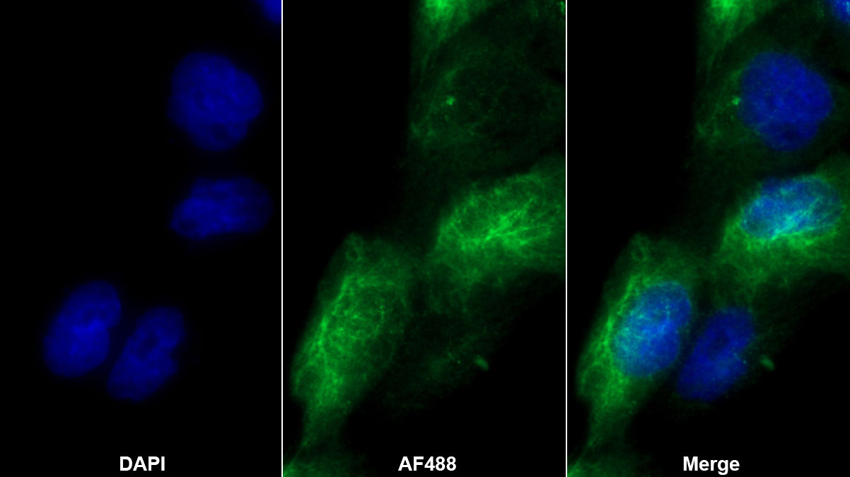 Polyclonal Antibody to Sp100 Nuclear Antigen (Sp100)