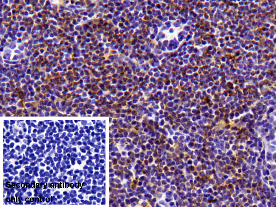 Polyclonal Antibody to Neutrophil Cytosolic Factor 4 (NCF4)