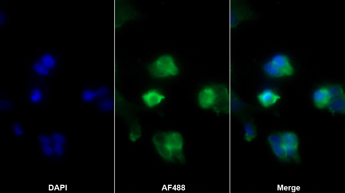 Polyclonal Antibody to Neutrophil Cytosolic Factor 4 (NCF4)