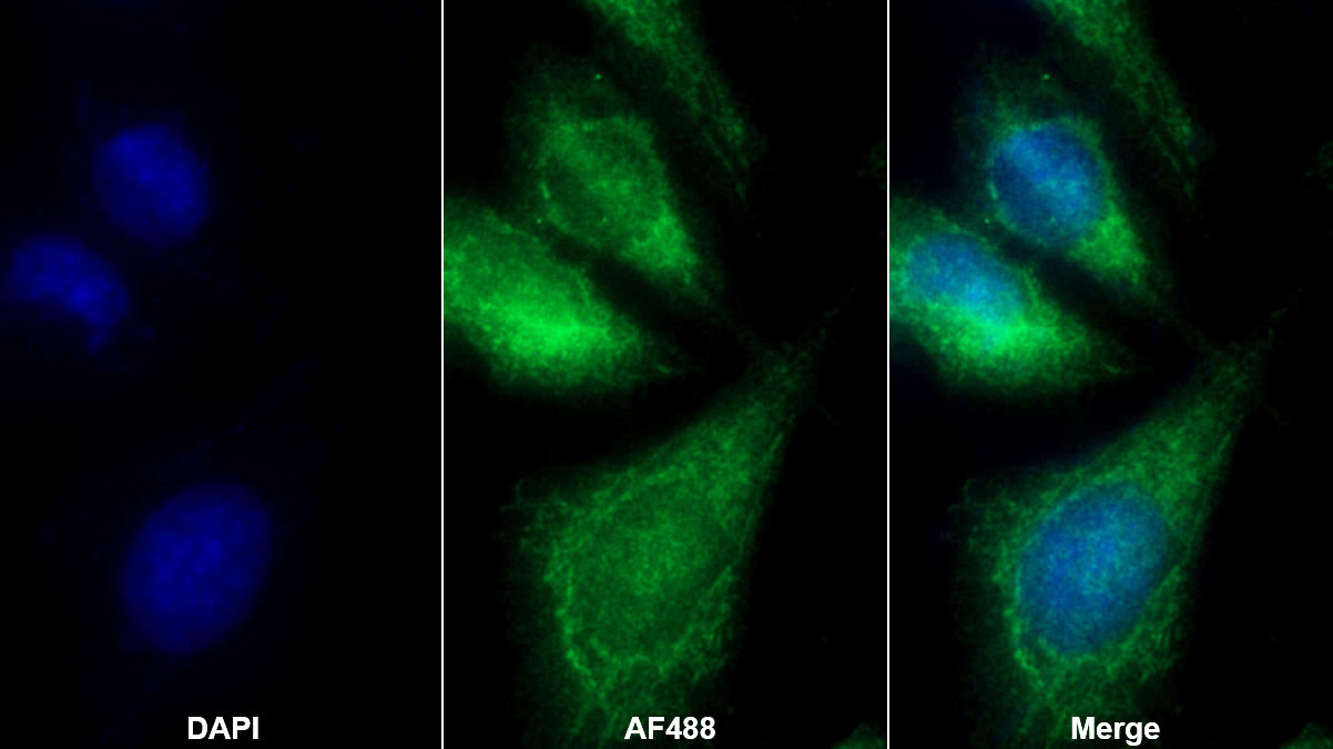 Polyclonal Antibody to Microtubule Associated Protein 1A (MAP1A)