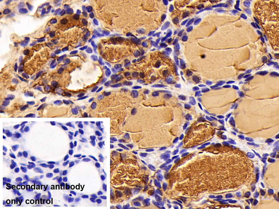 Polyclonal Antibody to Thyroglobulin (TG)