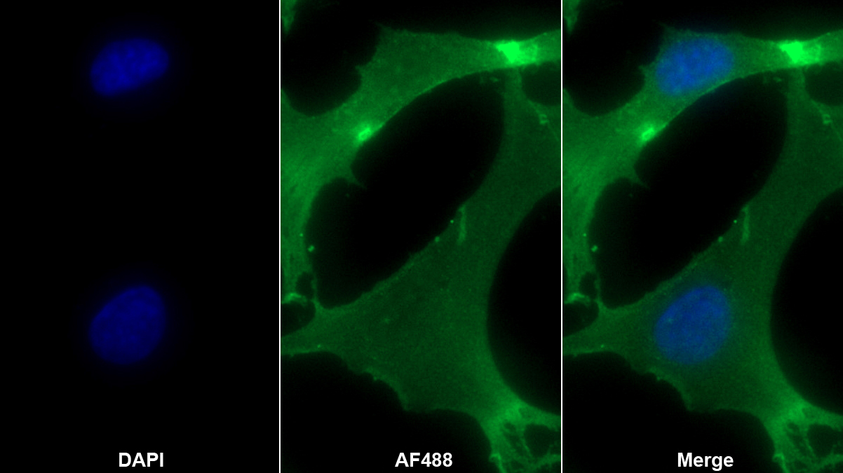 Polyclonal Antibody to Platelet/Endothelial Cell Adhesion Molecule (PECAM1)