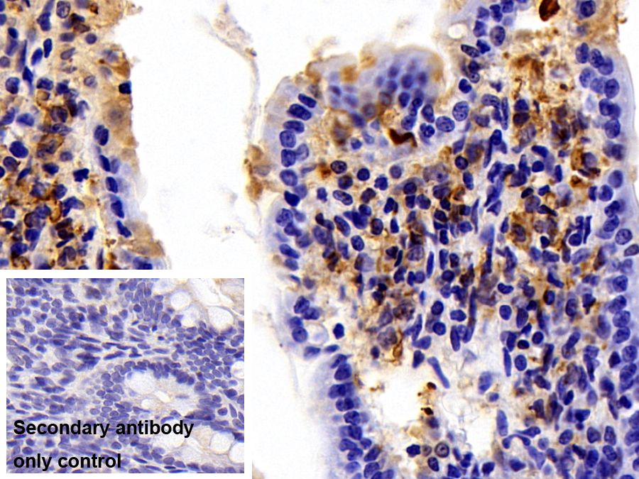 Polyclonal Antibody to Gelsolin (GSN)