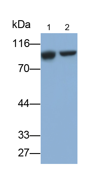 Polyclonal Antibody to Gelsolin (GSN)