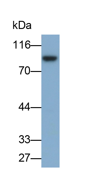 Polyclonal Antibody to Gelsolin (GSN)