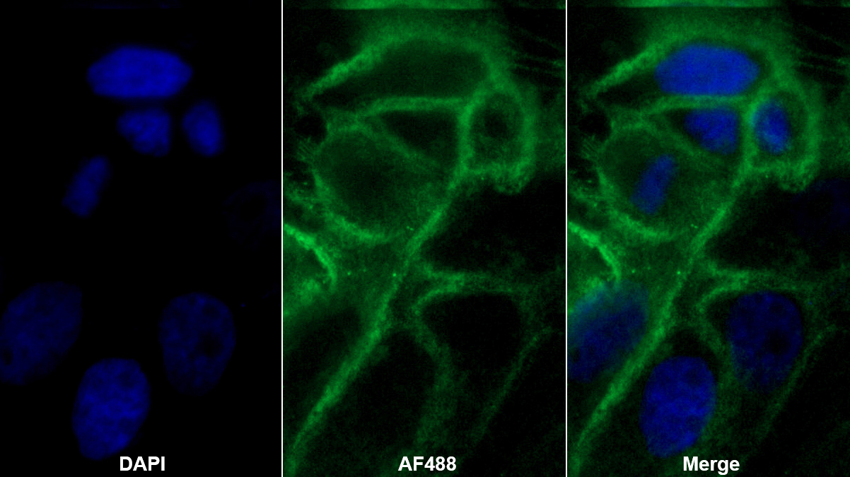 Polyclonal Antibody to Cholecystokinin 4, Tetrapeptide (CCK4)