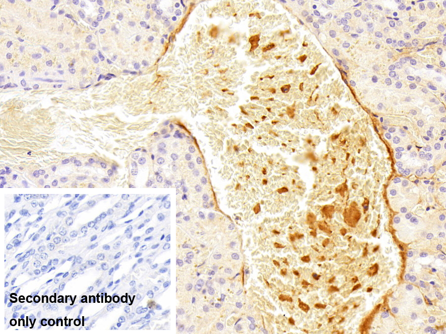 Polyclonal Antibody to Complement Component 3a (C3a)