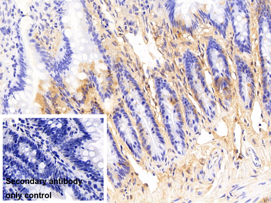 Polyclonal Antibody to Complement Component 3a (C3a)