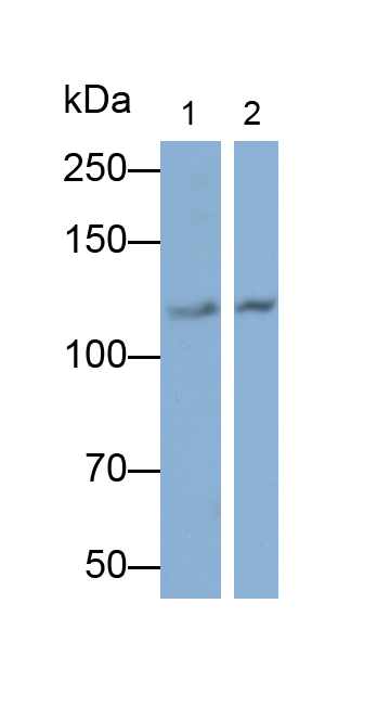 Polyclonal Antibody to Complement Component 5a (C5a)