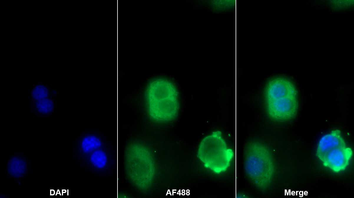 Polyclonal Antibody to Sex Hormone Binding Globulin (SHBG)