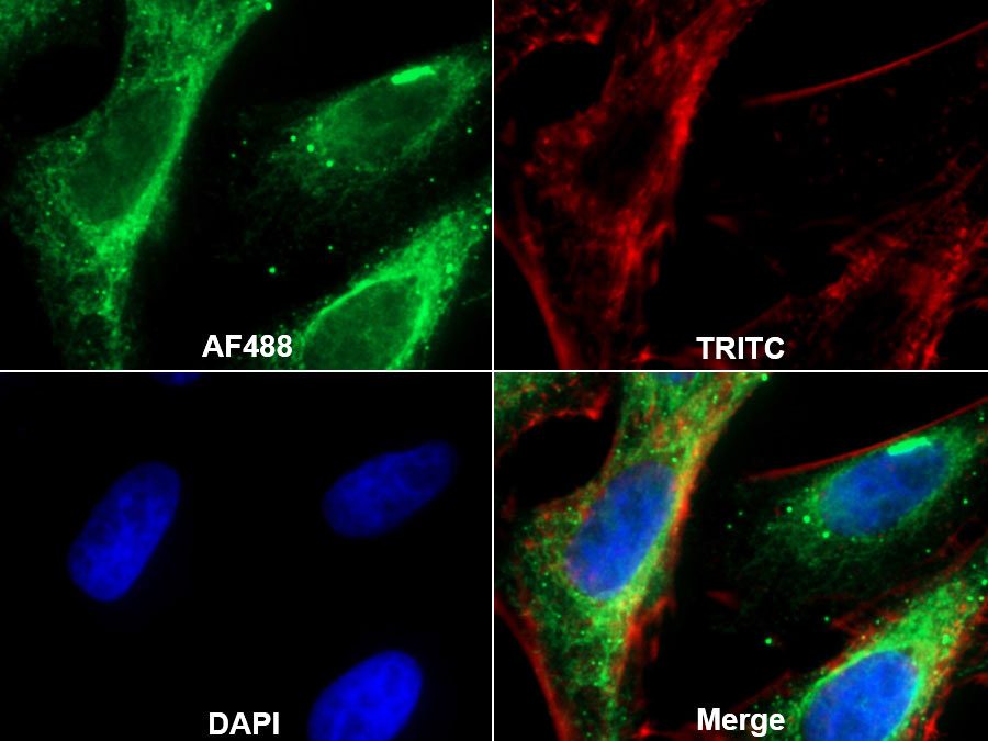 Polyclonal Antibody to Elastin Microfibril Interface Located Protein 1 (EMILIN1)