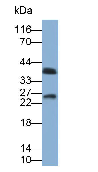 Polyclonal Antibody to Synaptophysin (SYP)