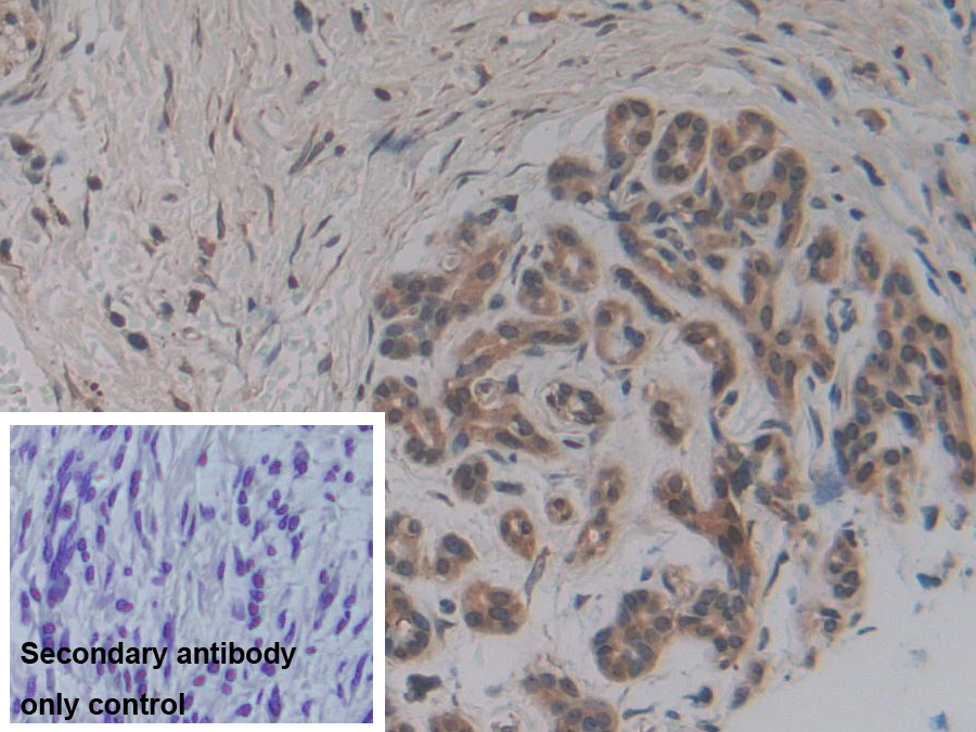 Polyclonal Antibody to Apoptosis Associated Tyrosine Kinase (AATK)