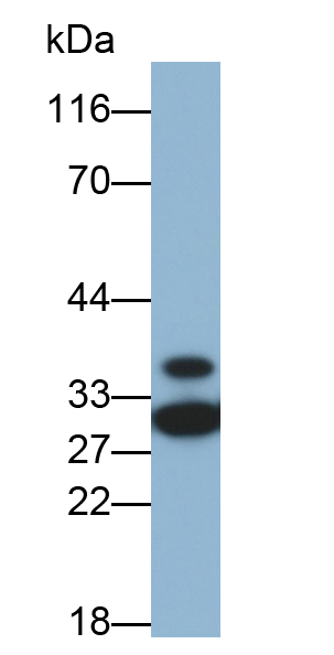 Polyclonal Antibody to Prohibitin (PHB)