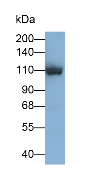 Polyclonal Antibody to Desmoglein 3 (DSG3)