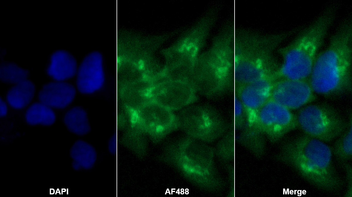 Polyclonal Antibody to Caspase 14 (CASP14)