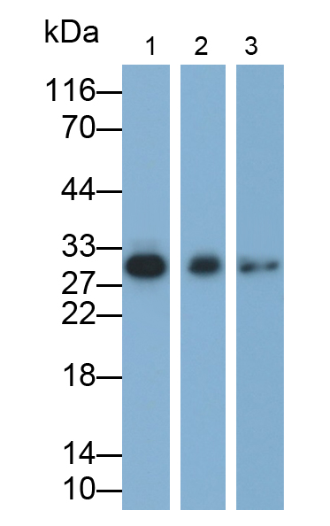 Polyclonal Antibody to Cardiac Troponin I (cTnI)