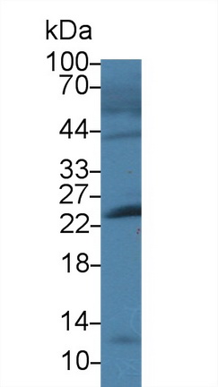 Polyclonal Antibody to Cardiac Troponin I (cTnI)