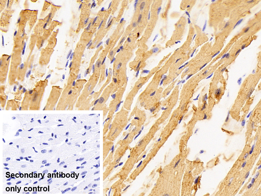 Polyclonal Antibody to Creatine Kinase MB Isoenzyme (CKMB)