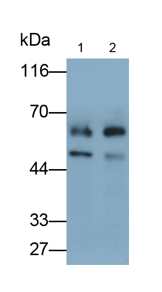 Polyclonal Antibody to Lymphotoxin Beta Receptor (LTbR)