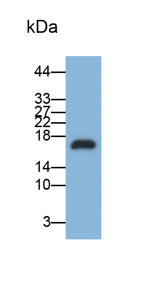 Polyclonal Antibody to N-Terminal Pro-Brain Natriuretic Peptide (NT-ProBNP)