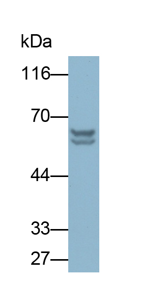 Polyclonal Antibody to Cytokeratin 5 (CK5)